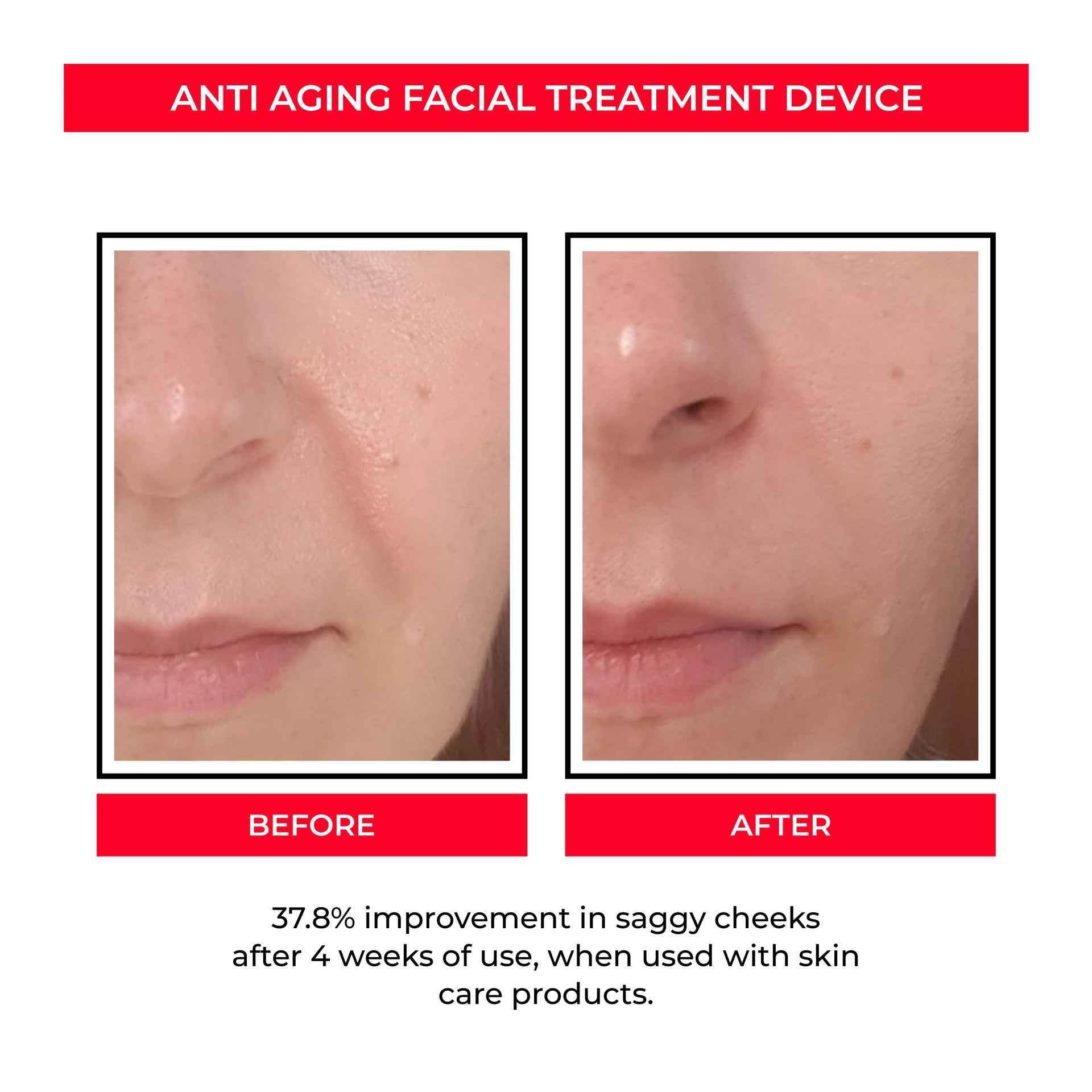 Beauty Instrument Pore Convergence EMS Skin Rejuvenation Micro Current 56bcc3d7-379f-440a-94d6-e9d736bd39e0 Print Material