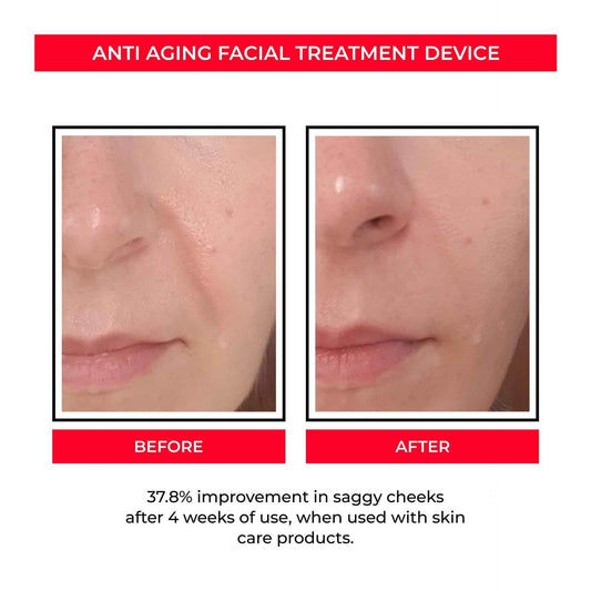 Beauty Instrument Pore Convergence EMS Skin Rejuvenation Micro Current 56bcc3d7-379f-440a-94d6-e9d736bd39e0 Print Material